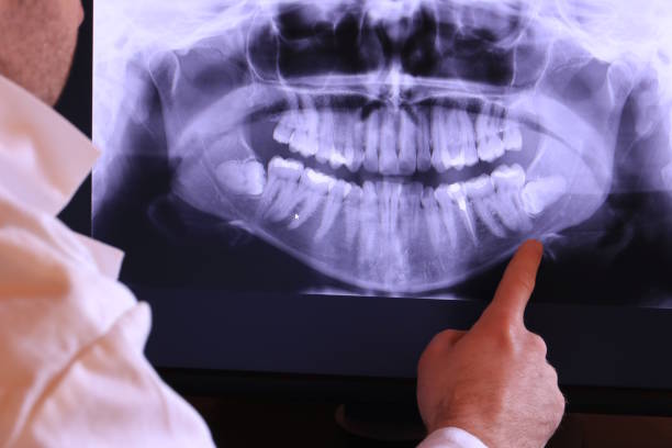 Best Emergency Treatment for Dental Infections or Abscesses in Gila Bend, AZ